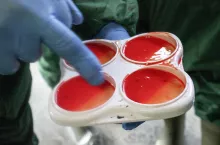 Mastitis może zwiększać ślad węglowy produkcji mleka, ponieważ krowy chore na zapalenie wymienia wykazują istotnie wyższą intensywność emisji metanu.