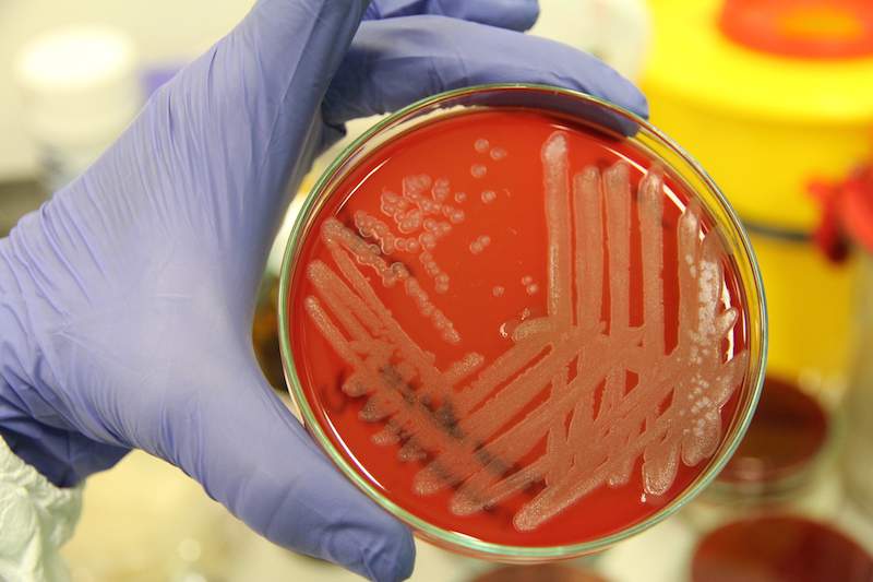 Bakteriologia jest jednym z najpowszechniej wykonywanych badań  laboratoryjnych świń